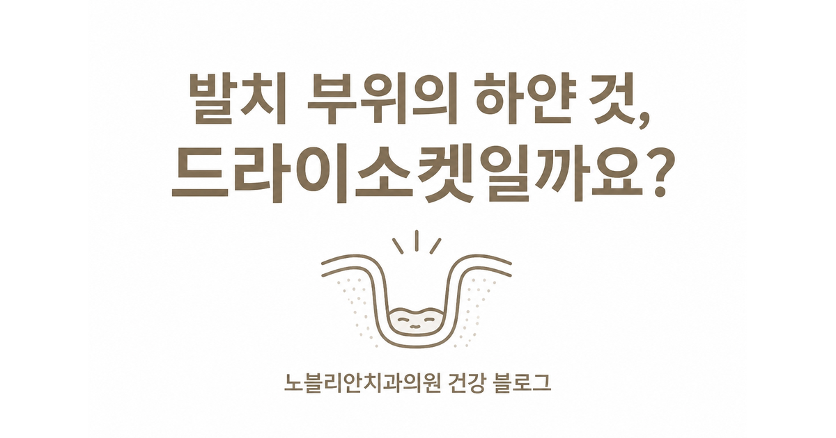 발치 부위의 하얀 것, 드라이소켓일까요?