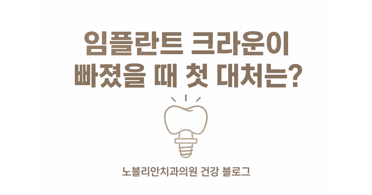 임플란트 크라운이 빠졌을 때 첫 대처는?